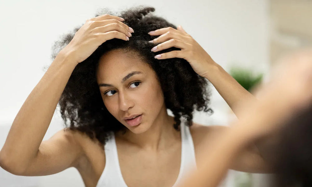 Alopecia prematura