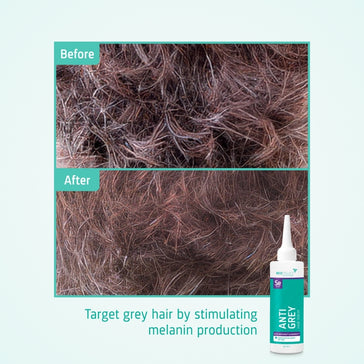 Neofollics Anti-Grau Haarserum Neofollics Anti-Grau Haarserum - Hairgivers