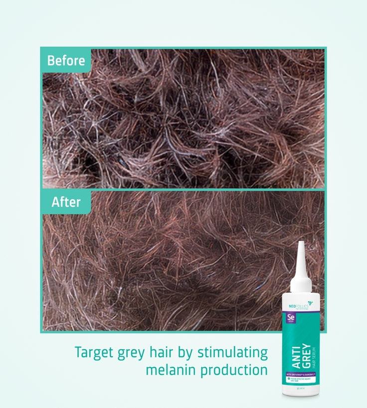 Neofollics Anti-Grau Haarserum