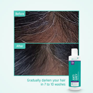 Neofollics Anti-Grau Shampoo Neofollics Anti-Grau Shampoo