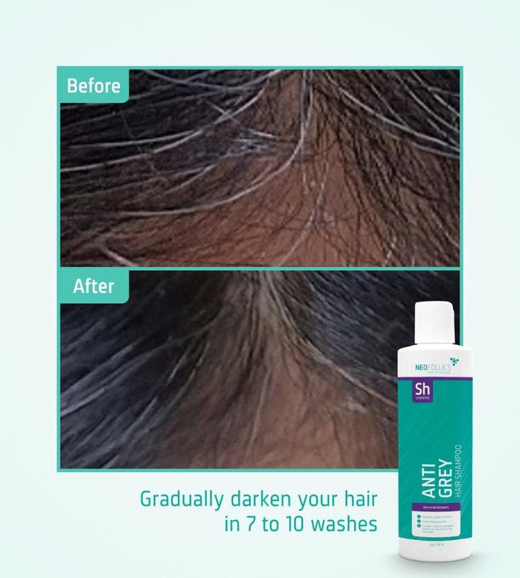 Neofollics Anti-Grau Shampoo
