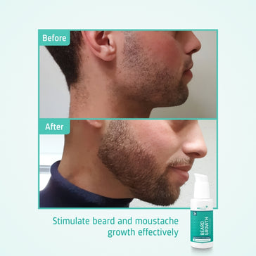 Neofollics Bartserum 3-Pack (7% Neoxyl) Neofollics Bartserum 3-Pack (7% Neoxyl) - Hairgivers
