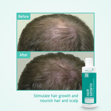 Neofollics Conditioner Neofollics Conditioner - Hairgivers