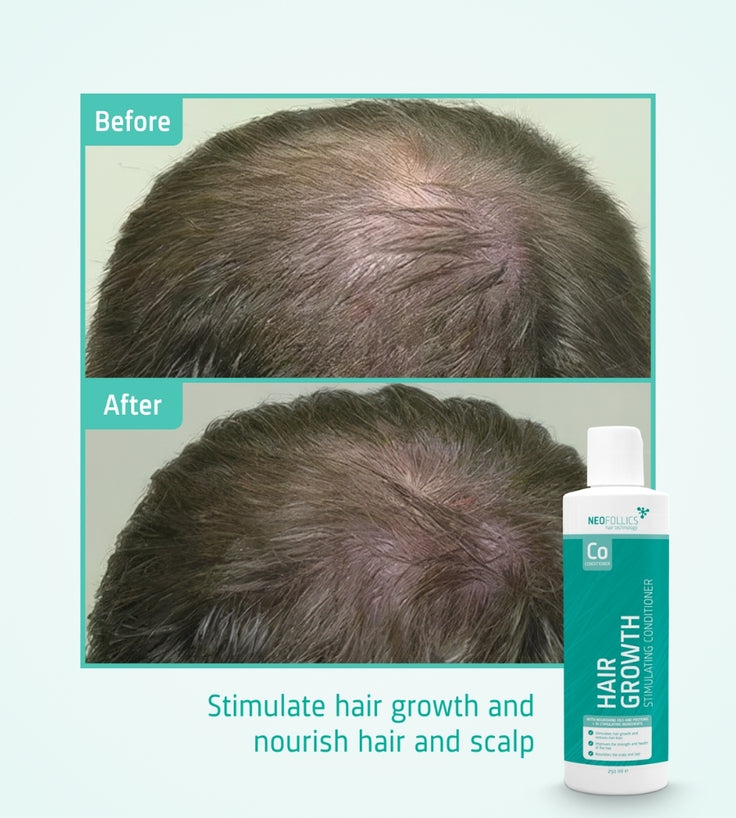 Neofollics Conditioner