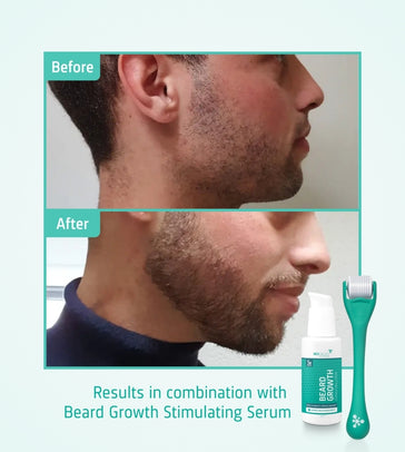 4x Neofollics Bartserum + kostenlose Bartroller 4x Neofollics Bartserum + kostenlose Bartroller - Hairgivers
