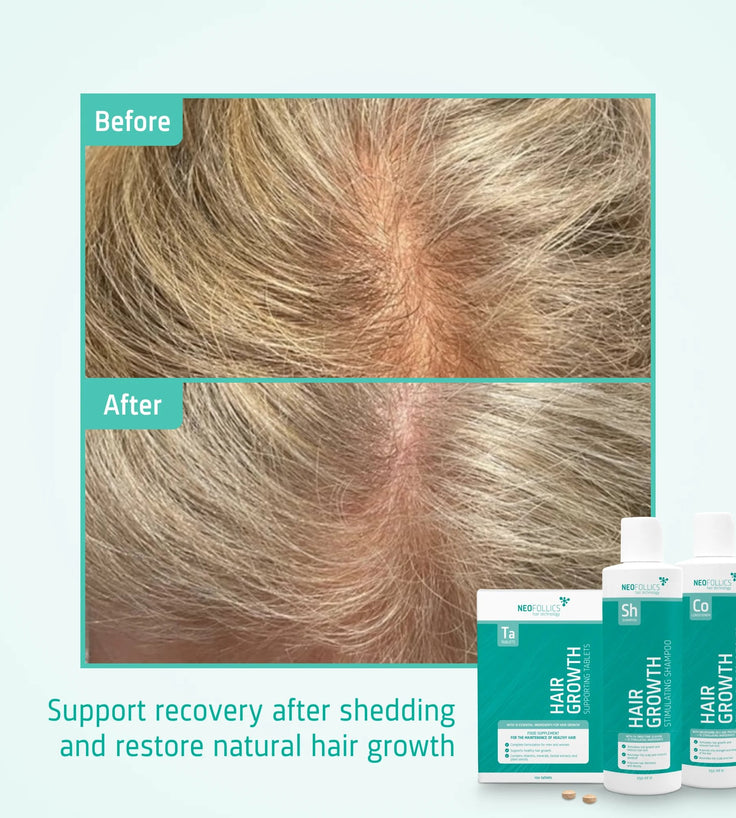 Neofollics Shampoo + Conditioner + Tabletten