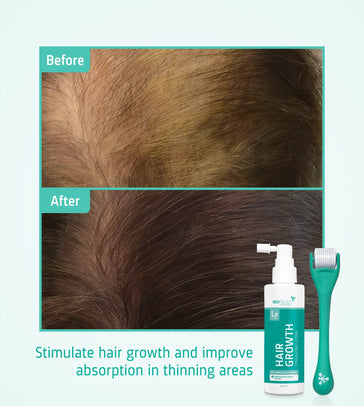 Neofollics Haarwuchs Serum + Roller Neofollics Haarwuchs Kit - Hairgivers
