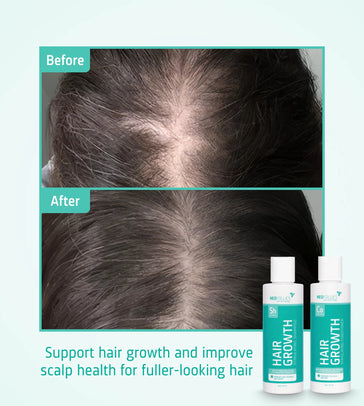 Neofollics Shampoo + Conditioner Starter-Kit Neofollics Shampoo + Conditioner Starter-Kit - Hairgivers