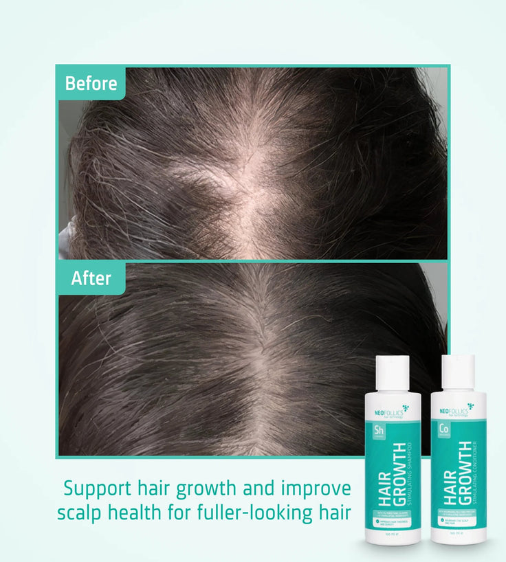 Neofollics Shampoo + Conditioner Starter-Kit