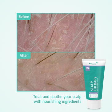 Neofollics Pflegende Maske Neofollics Pflegende Maske - Hairgivers