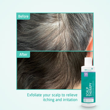Neofollics Peeling Shampoo Neofollics Peeling Shampoo - Hairgivers