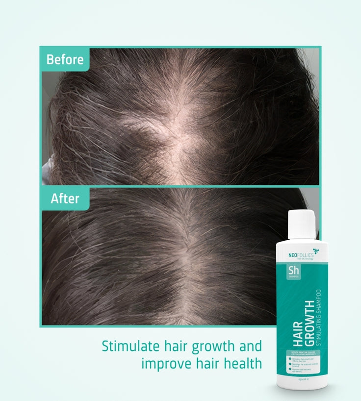 Neofollics Shampoo gegen Haarausfall 3-Pack (3x250 ml)