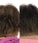 Foligain Haarwuchsbehandlung (Frau) - Hairgivers