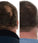 Foligain Shampoo + Conditioner für Männer (236 ml) Kombi-Packung - Hairgivers