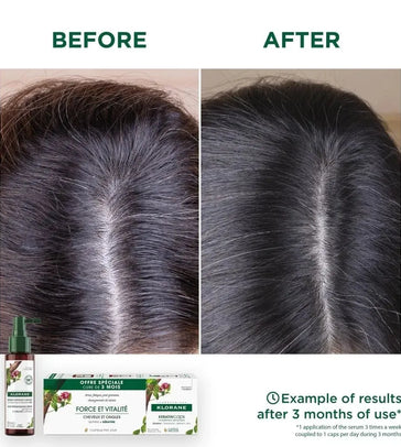 Klorane Anti-Haarausfall-Behandlung Klorane Anti-Haarausfall-Behandlung - Hairgivers