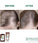 Klorane Anti-Haarausfall Shampoo Chinin/Edelweiss (200 ml) - Hairgivers