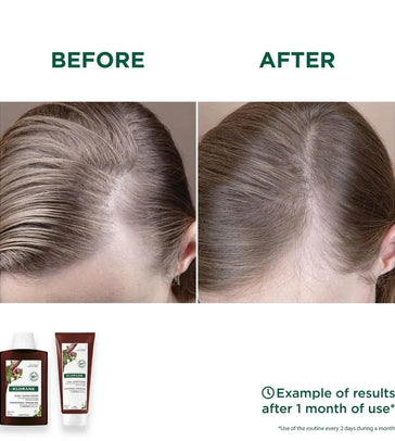 Klorane Anti-Haarausfall Shampoo + Conditioner Klorane Anti-Haarausfall Shampoo + Conditioner - Hairgivers