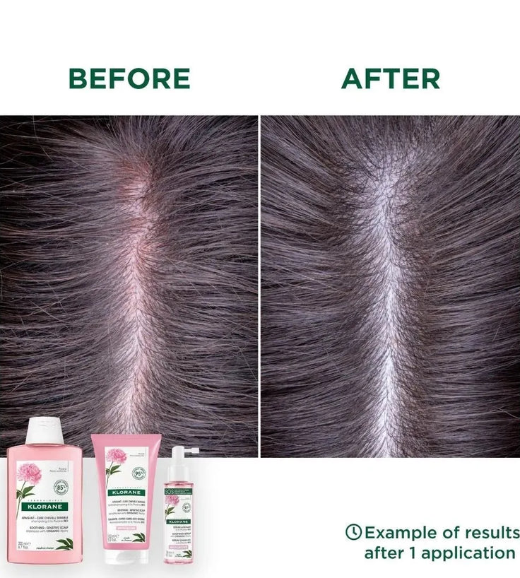 Klorane Shampoo Pfingstrose - empfindliche Kopfhaut (400 ml) - Hairgivers