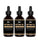 Mzel Batana-Öl 3-Pack (3x60 ml) - Hairgivers