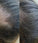 Panthrix Haarwuchs Aktivator (Redensyl) Serum - Hairgivers