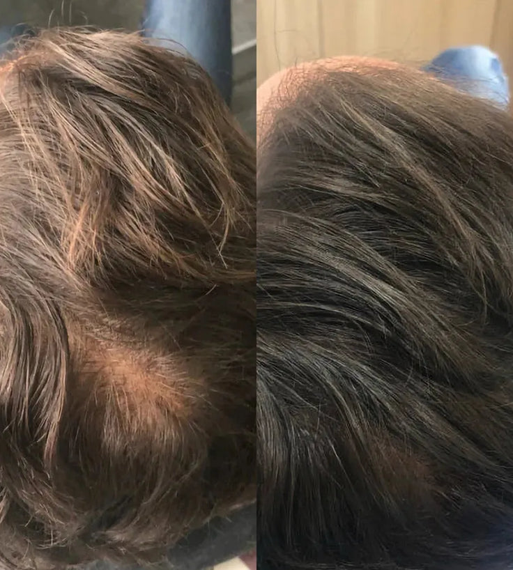 Revita Shampoo gegen Haarausfall (925ml) - Hairgivers