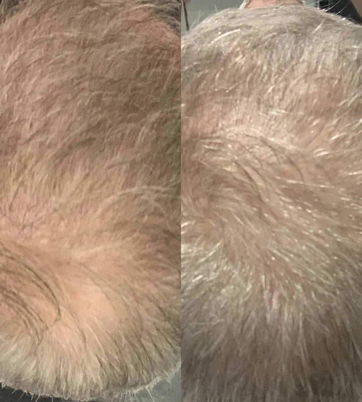 Scandinavian Biolabs Conditioner für Männer (250 ml) - Hairgivers