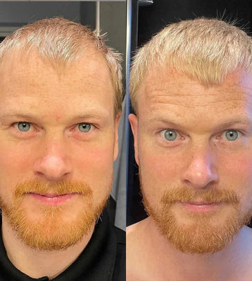 Scandinavian Biolabs Shampoo + Conditioner für Männer Kombi-Packung Scandinavian Biolabs Shampoo + Conditioner für Männer Kombi-Packung - Hairgivers