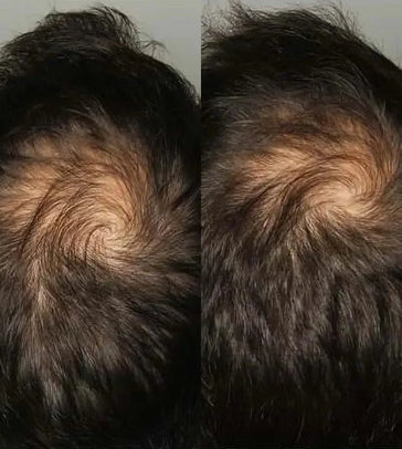 Viviscal Haarwachstum-Tabletten für Männer (1 Monat) Viviscal Haarwachstum-Tabletten für Männer (1 Monat) - Hairgivers