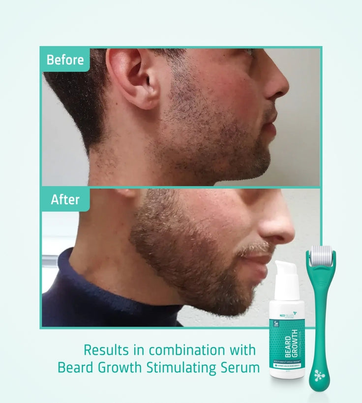 Neofollics Bartserum + Roller
