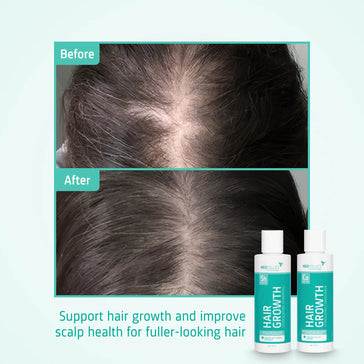 Neofollics Shampoo + Conditioner Starter-Kit - Hairgivers