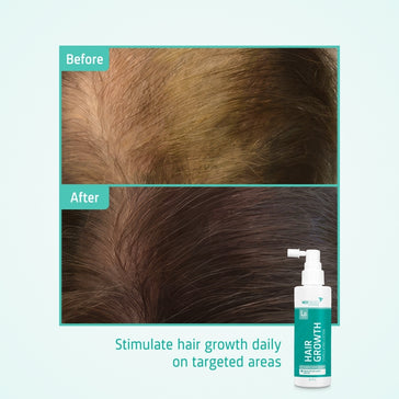 Neofollics Serum gegen Haarausfall (7% Neoxyl) - Hairgivers