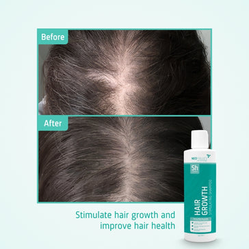 Neofollics Shampoo gegen Haarausfall 3-Pack (3x250 ml) - Hairgivers