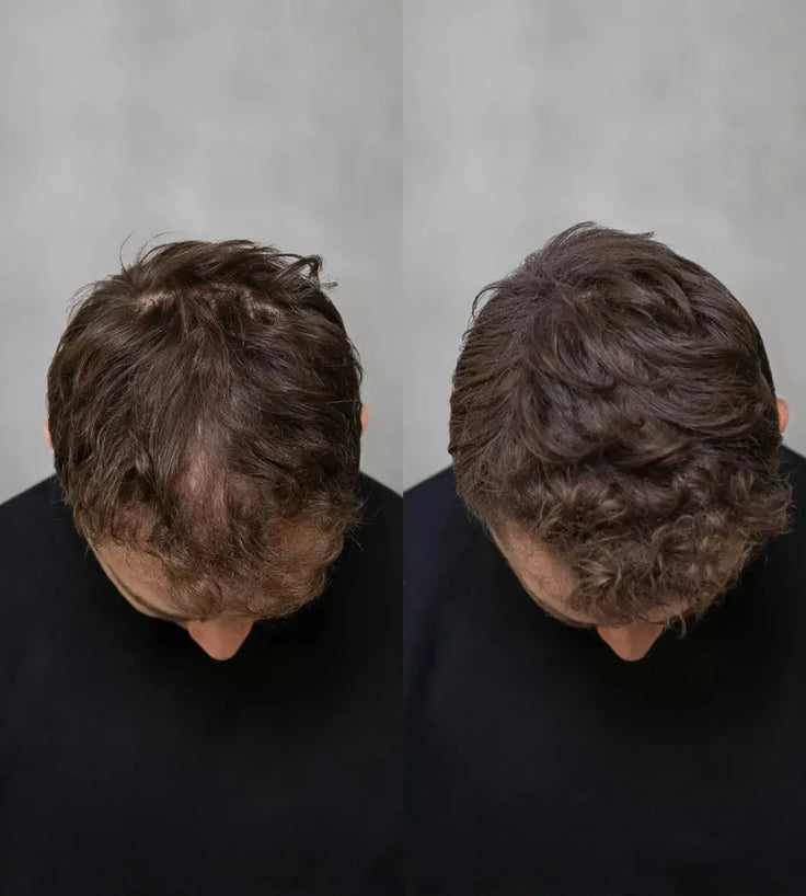 Keratain Streuhaar - Dunkelbraun (25 gr) - Hairgivers