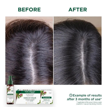 Klorane Anti-Haarausfall-Behandlung - Hairgivers