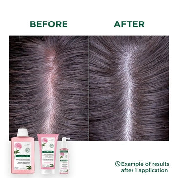 Klorane Behandlung für empfindliche Kopfhaut - Hairgivers