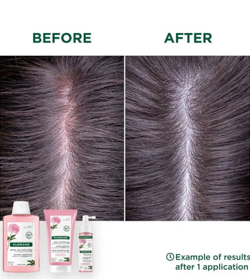 Klorane Behandlung für empfindliche Kopfhaut - Hairgivers