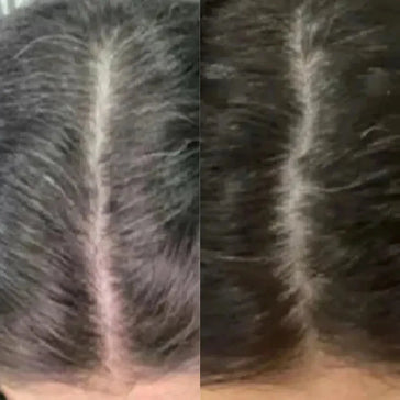 Neofollics Anti-Grau Haartabletten - Hairgivers