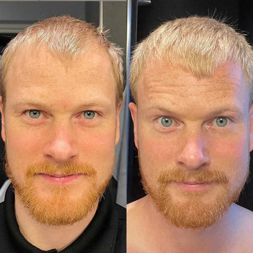 Scandinavian Biolabs Shampoo + Conditioner für Männer Kombi-Packung - Hairgivers