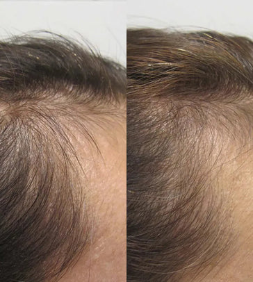 Viviscal Haarwachstums-Tabletten für Frauen (1 Monat) - Hairgivers